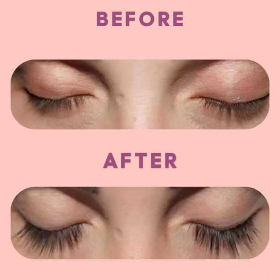 Eyelash Growth Serum